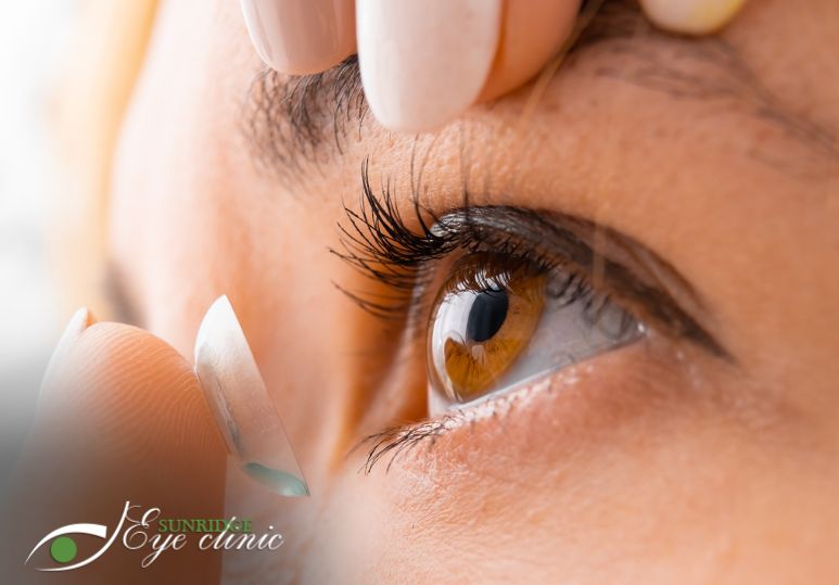 Tips for First-Time Contact Lens Wearers: A Beginner's Guide to Comfortable and Successful Wear